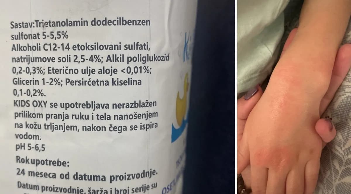 Povlačenje sapuna "Kids Oxy" iz vrtića izaziva zabrinutost među roditeljima