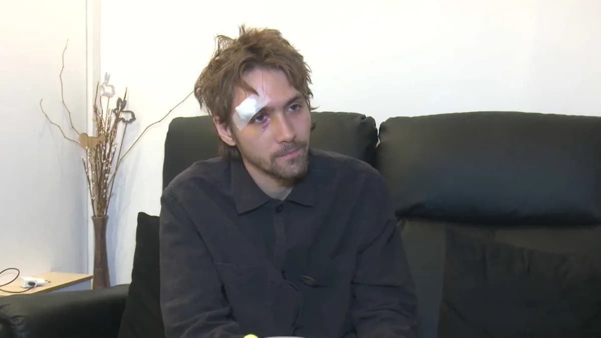 Student Lazar Dinić pretučen tokom izbora: Očekuje operaciju